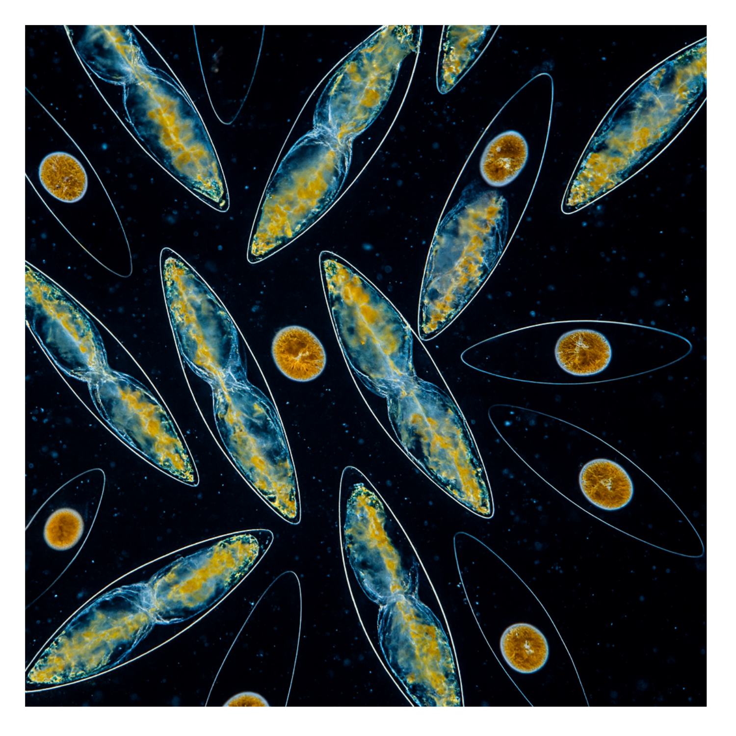 Hier siehst du eine Mikroskop-Aufnahme von Dinoflagelaten bei Tag - also Leuchtalgen namens Pyrocystis lunula. Tagsüber erscheinen sie braun-gelb, manchmal auch leicht rost- oder rosafarben. Sie sind in der Lage durch natürliche chemische Reaktionen ein nächtliches Leuchten herzustellen.